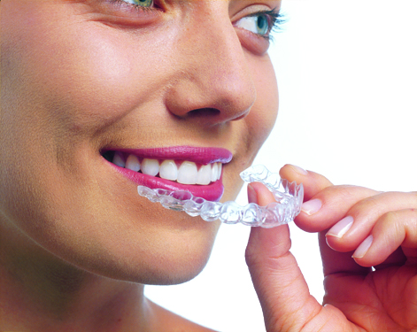 Invisalign System, Invisalign Springfield